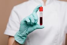 Image of nurse holding a vial of blood.